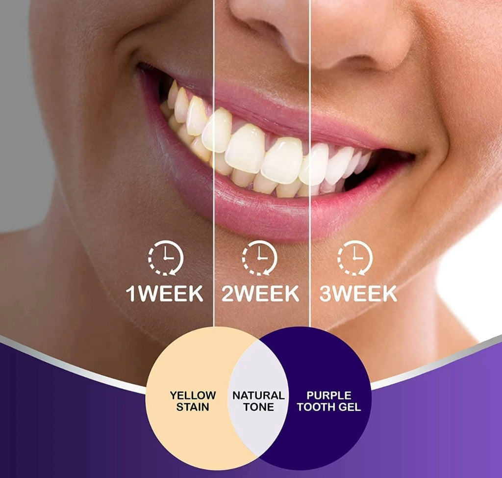 ✨ HISMILES V34 : Correcteur de Couleur Dentaire & Soin Éclat du Sourire