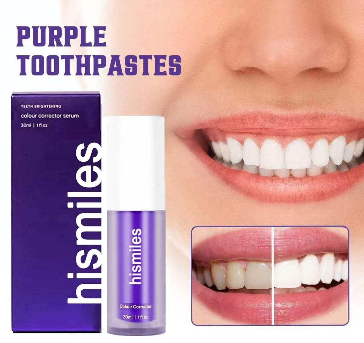 ✨ HISMILES V34 : Correcteur de Couleur Dentaire & Soin Éclat du Sourire