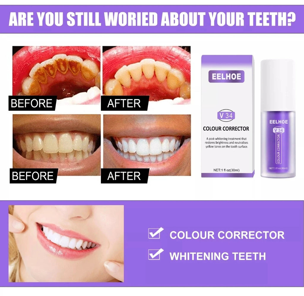 ✨ HISMILES V34 : Correcteur de Couleur Dentaire & Soin Éclat du Sourire